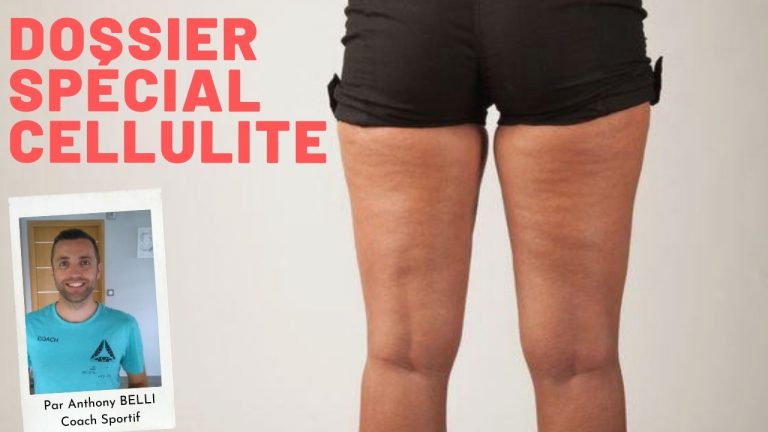Dossier spécial Cellulite